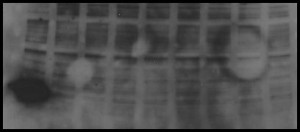 A Western blot with different types of background.