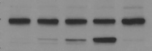 Example of a publication quality Western blot.